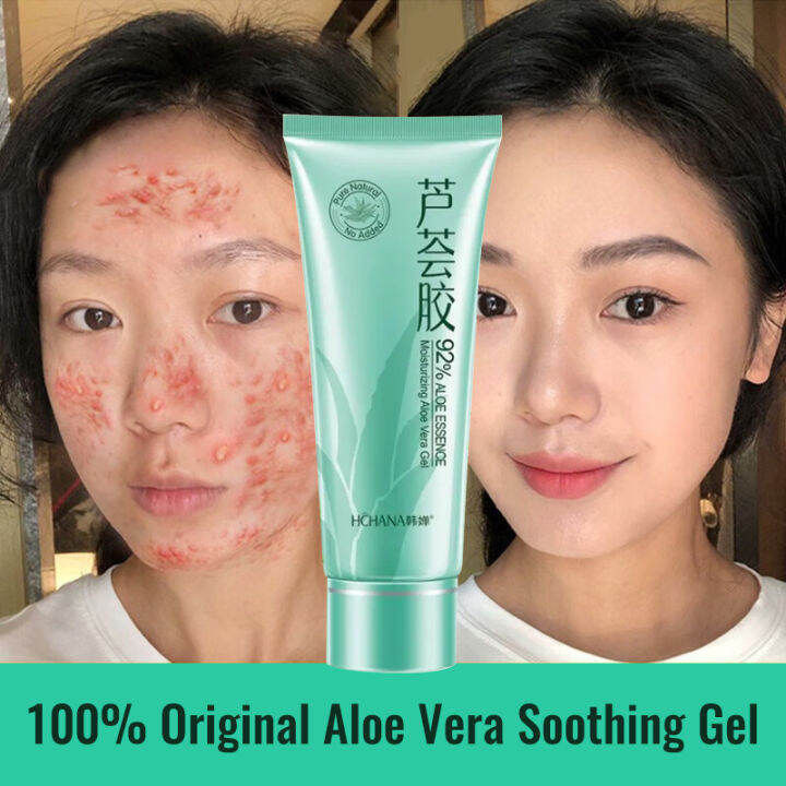 Original Aloe Vera Collagen Soothing Gel Removes Acne Moisturizing with ...