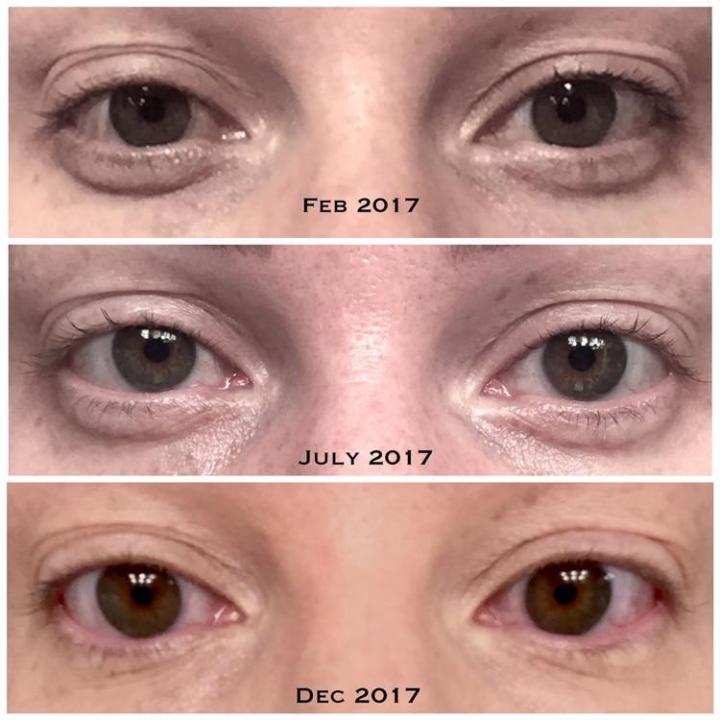 the-ordinary-เซรั่มบำรุงรอบดวงตา-5-คาเฟอีน-egcg-ช่วยลดอาการบวมลดความหมองคล้ำกระชับต่อต้านริ้วรอย30ml-เซรั่มบำรุงผิว-เซรั่มบำรุงรอบดวงตา