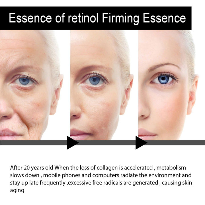 zwm-retinol-anti-aging-removal-wrinkle-serum-firm-lift-fade-fine-lines-moisturizing-face-essence-skin-care-brighten-repair-cosmetic