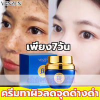 ?VENZEN ครีมไวท์เทนนิ่ง ครีมทาฝ้ากระ กำจัดฝ้า จุดด่างดำ ฝ้า กระ ริ้วรอย ครีมลบฝ้า ครีมแก้ฝ้าลึก ครีมทาผิวขาว ไวท์เทนนิ่งกระ ครีมทาฝ้าหนาๆ ครีมทาหน้าขาว ครีมทาฝ้า ครีมหน้าใสเด้ง กระจ่างใส ลดเม็ดสีเมลานิน ครีมถาหน้าขาว50g（ครีมหน้าขาวใส ครีมลดฝ้า)