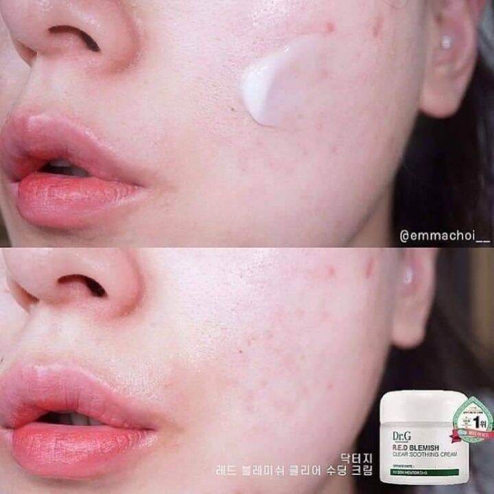 พร้อมส่ง-dr-g-red-blemish-clear-soothing-cream-ขนาด70ml