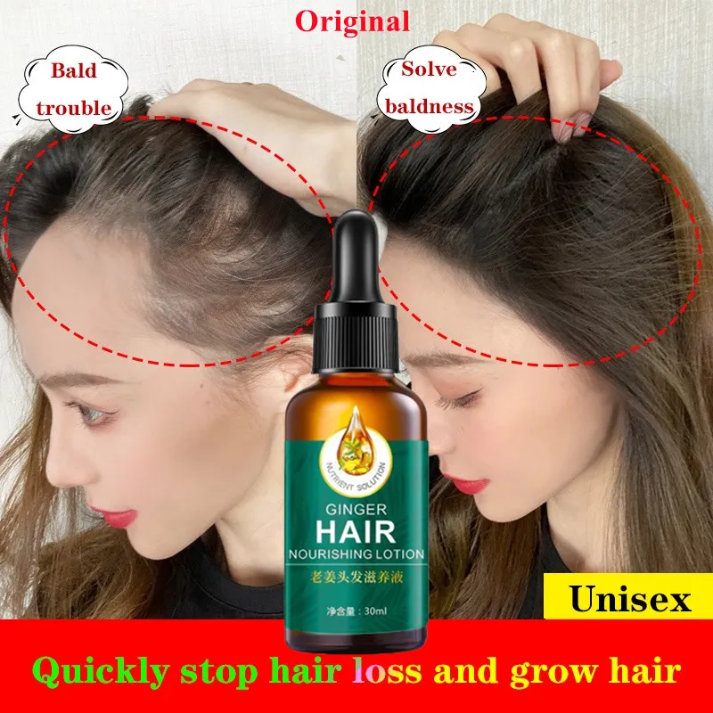 Natural ginger Hair Serum Hair Grower Fast Long Hair Hair Treatment For Hair Growth Spray Essence Hair Loss Treatment For Men And Women | Lazada PH Natural ginger Hair Serum Hair Grower Fast Long Hair Hair Treatment For Hair Growth Spray Essence Hair Loss Treatment For Men And Women | Lazada PH