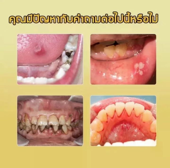 ยาสีฟันพิษผึ้ง-110g-ป้องกันและชะลอฟันผุได้อย่างมีประสิทธิภาพ-ปกป้องเหงือกและฟัน-ลมหายใจสดชื่น-ยาสีฟันไวท์เทนนิ่ง-ยาสีฟัน-ยาสีฟันลดกลิ่นปาก-ยาสีฟันลดกลิ่นปาก-ยาสีฟันดับกลิ่น-ยาสีฟันฟันขาว
