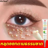 【ซื้อ 2 แถม 1】Aichunครีมบำรุงรอบดวงตา เซรั่มทาถุงใต้ตา 30ml ลบคล้ำบวมใต้ตา กระชับรอยตีนกา บรรเทาปัญหาต่างๆรอบดวงตา (คนีมบำรุงรอบดวงตา ครีมทาตาเม็ดไขมัน ครีมบำรุงรอบตา เซรั่มถุงใต้ตา ครีมลดริ้วรอบดวงตา ครีมทาใต้ตาดำ บำรุงสายตา ครีมทาตาดำ เซรั่มอายครีม）