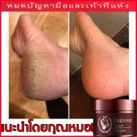 CINDYNALน้ำมันม้า110g? ให้มือและเ ท้าของคุณ ไม่ร้าวอีกต่อไป ป้องกันการสูญเสียความชื้นจากผิวเท้า บำรุงผิวเท้าที่แห้ง （ครีมส้นเท้าแตก ครีมทาส้นเท้าแตก ครีมนวดเท้า ดูแลเท้า น้ำมันม้า ครีมทาเท้า  ครีมทาเท้าขาว）