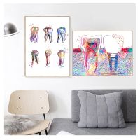 【hot】┇✿๑  Canvas Print Dentist Wall Painting Medicine Hygienist Poster Watercolor Picture Implant