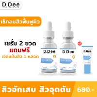 [เซ็ทคู่รักษาสิว] D.Dee เซรั่มรักษาสิวและเจลแต้มสิว แนะนำสำหรับคนที่เป็น สิวเรื้อรัง สิวอักเสบ สิวอุดตัน สิวผด สิวแพ้สาร