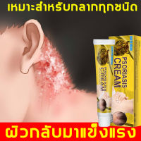 ?ได้ผล 100% ไม่เด้งกลับ?SOUTH MOON ครีมแก้คัน ครีมสมุนไพรแท้ โรคผิวหนัง สารสกัดจากพืชใช้ได้ทั้งตัวบอกลาผิวคันได้ง่ายๆ（ครีมสมุนไพรแท้ ครีมลดอาการคัน สะเก็ดเงิน กลาก） itchingcream