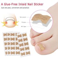 50/100PC Nail Correction Stickers Ingrown Toe Nail Corrector Elastic Patch Sticker Straightening Clip Brace Pedicure Tools