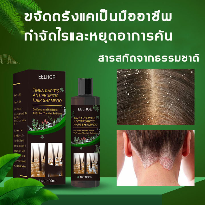 ดูแลหนังศีรษะ-eelhoe-แชมพูขจัดรังแค-แชมพูคัน-แชมพูยาเชื้อรา-100ml-ขจัดรังแค-หยุดอาการคัน-ลดผมร่วง-ยาสระผมขจัดรังแค-ดูแลหนังศีรษะ-ยาสระผมแก้เชื้อรา-ควบคุมน้ำมัน-ขจัดรังแค-ยาสระผมเชื้อรา-แชมพูสมุนไพรยาส