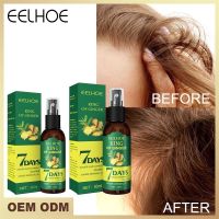 EELHOE สเปรย์ปลูกผม 30ml เจริญเติบโตของเส้นผมอย่างรวดเร็ว ส่งเสริมการเจริญเติบโตของรูขุมขน