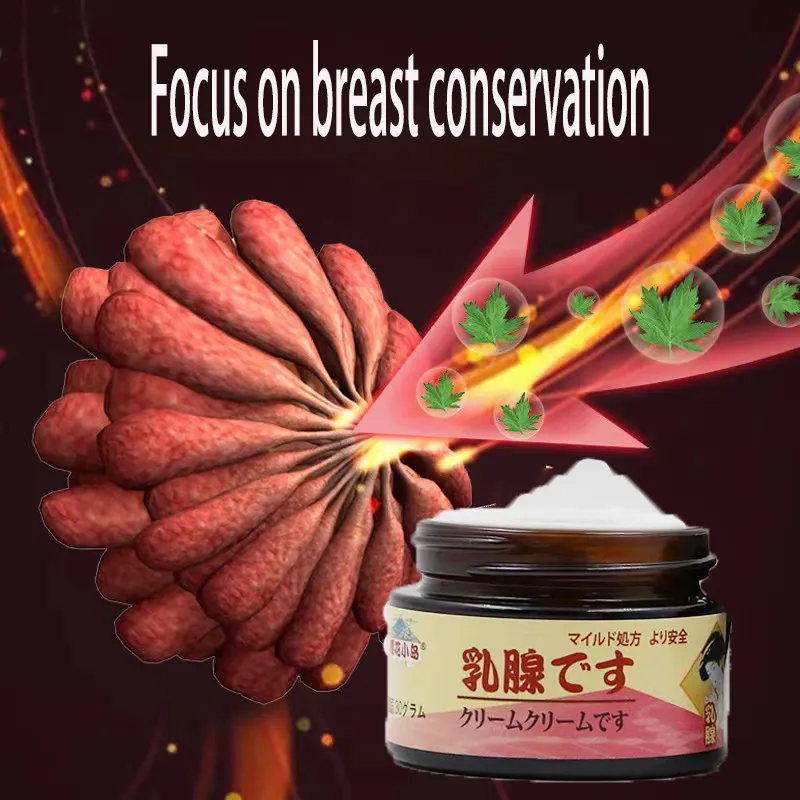 Women Health Care Cream Treat Hyperplasia Chornic Mastitis Medical,anti  Breast Cancer Swelling Breast Pain Relief Ointment