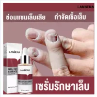 LANBENA เซรั่มบำรุงเล็บ เชื้อราเล็บมือ แก้เชื้อราที่เล็บ บำรุงเล็บ ลากับเล็บเสีย ไม่ทำร้ายเล็บดี ห่างกับปัญหาเล็บ ซ่อมแซมเล็บ