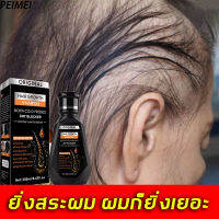 【การส่งมอบกรุงเทพฯ】ซ่อมแซมรูขุมขน สระออกผมหนาแน่น PEIMEI แชมพูลดผมร่วง ป้องกันผมล่วง บำรุงรากผม ปรับหยาบกร้าน การดูแลหนังศีรษะ เสริมสร้างเส้นผม (แชมพูแก้ผมร่วง/ยาสระผมเร่งยาว/แชมพูเร่งผมยาว/สระผมขิง/เซรั่มเร่งผมยาว/เซรั่มปลูกผม/แชมพูปลูกผมดก /แชมพูเร่งผมย