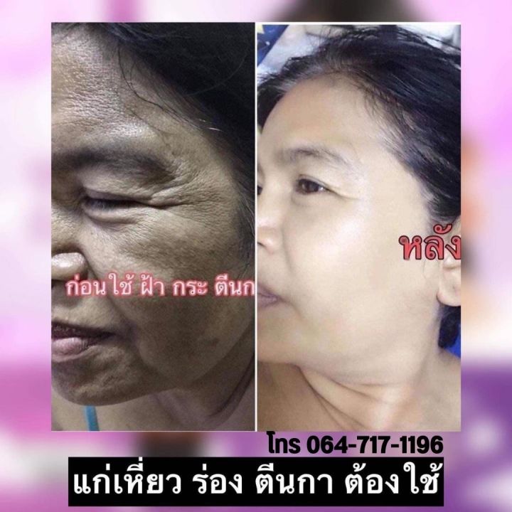 ถูกที่สุด-ของแท้-100-เซรั่มมายา-maya-ลดฝ้า-เซรั่ม-หน้าเด็ก-เซรั่มหน้าใส-เซรั่มโบท็อกซ์-มายา