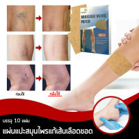 แผ่นแปะสมุนไพรแก้เส้นเลือดขอด (Eelhoe Varicose Veins)