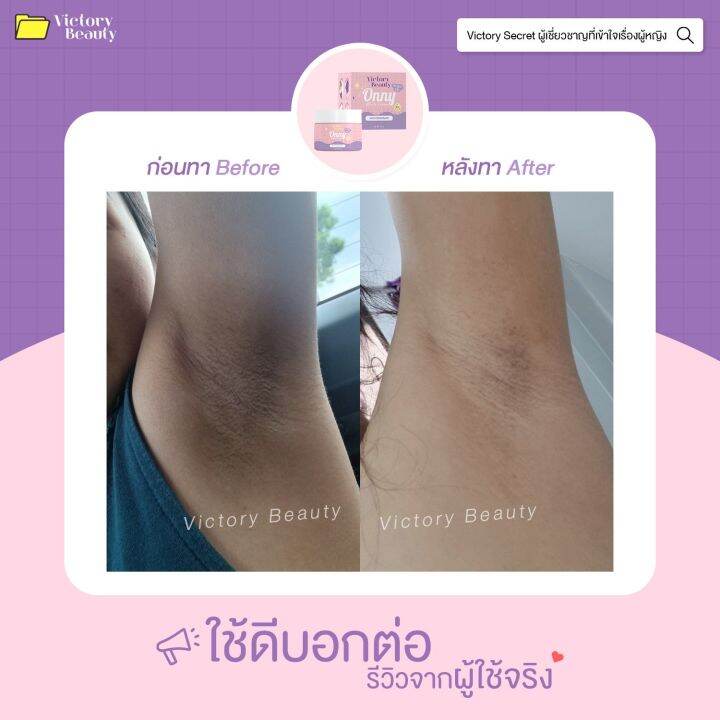 ส่งฟรี-ครีมรักแร้ขาว-onny-5-กรัม-สูตรโรงพยาบาลศัลยกรรมเกาหลี-ทาตรงไหนเนียนตรงนั้น-บอกลาผิวคล้ำ-ขาหนีบ-คอดำ-ข้อศอกดำ