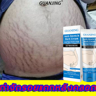 【พร้อมส่ง】 GUANJINGครีมลดรอยแตกลาย80g ครีมลดรอยแตกลาย รอยแตกลายจางลงและทำให้ผิวกระชับและเรียบ (ครีมกำจัดลอยแตก ​ครีมลดรอยแตก ครีมทาผิวขาลาย ครีมแก้ขาลาย ครีมทาท้อง ครีมท้องแตกลาย ครีมทาแตกลาย ครีมรอยแตกลาย ครีมลบรอยแตก ครีมลดลอยเเตก ครีมลดรอยแตกลาย ）