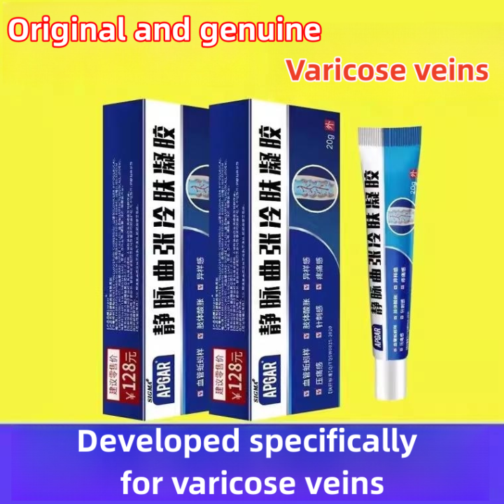 Varicose vein cold compress gel Relieve pain The blood vessels in the