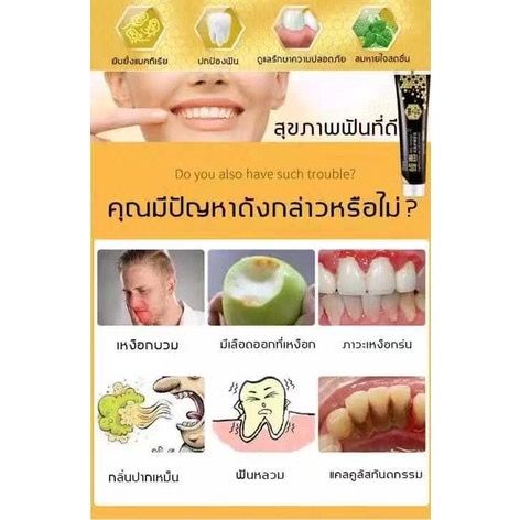 ยาสีฟันฟอกฟันขาว-ยาสีฟันฟันขาว-ยาสีฟันลดหินปูน-ช่องปาก-ยาสีฟันหินปูน-ยาสีฟันจัดฟันฟันขาว-ยาสีฟันขจัดหินปูน-ยาสีฟันขาว