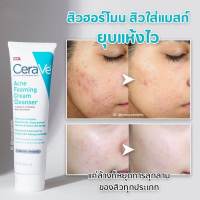 [ของแท้ 100%] CERAVE ACNE FOAMING CREAM CLEANSER BENZOYL PEROXIDE ACNE TREATMENT 150 ml.