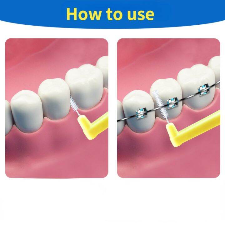 10pcs-l-shape-push-pull-interdental-brush-orthodontic-toothpick-teeth-whitening-tooth-pick-toothbrush-oral-hygiene-care