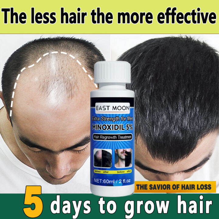 East Moon Minoxidil 5% Hair Growth (with collagen and castor oil) Fast ...