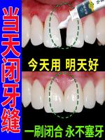 High efficiency Japan original Tooth gap repair artifact boutique desensitization oral care special toothpaste anti-moth anti-sensitivity tooth cavity cleaning RY