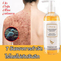 【ซื้อ 2 แถม 2】เจลอาบน้ำลดสิว  บรรเทาอาการคัน กำจัดไรฝุ่น ลดสิว ยับยั้งไร เจลอาบน้ำกำจัดไร  คุมน้ำมันสดชื่น ผิวเนียนนุ่มสัมผัสสบาย 260 มล.