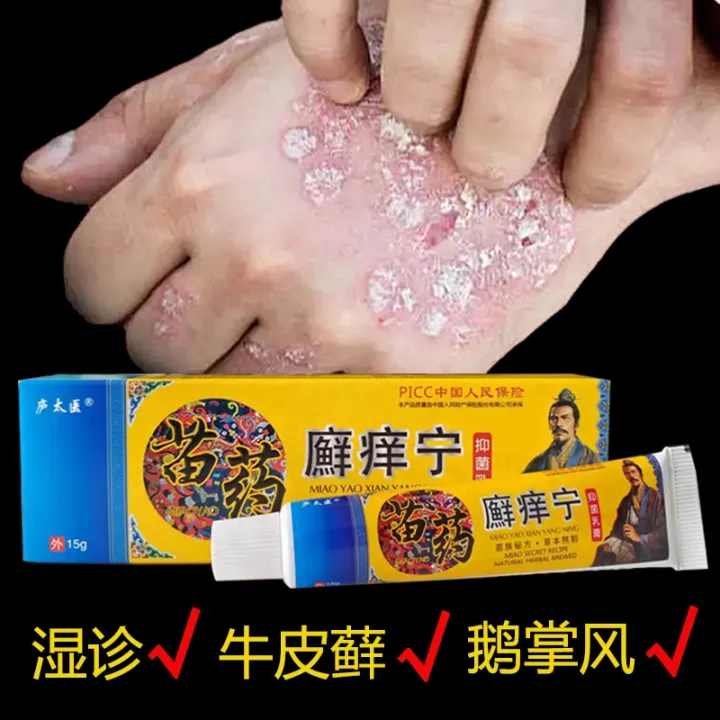 【Buy 2 Miao medicine antibacterial psoriasis eczema skin disease ...