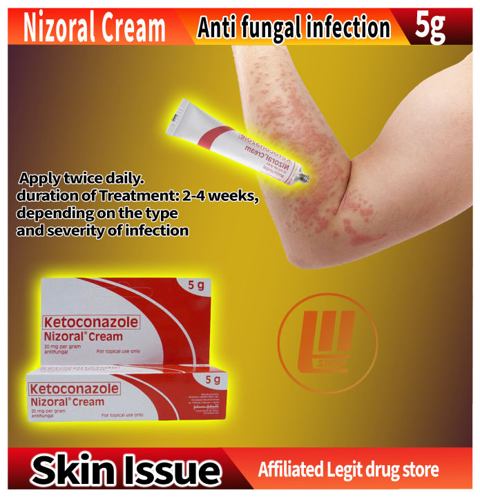 Nizoral Cream Treats Fungal Skin Infections Katikati Galis Hadhad Buni Lazada Ph 3116