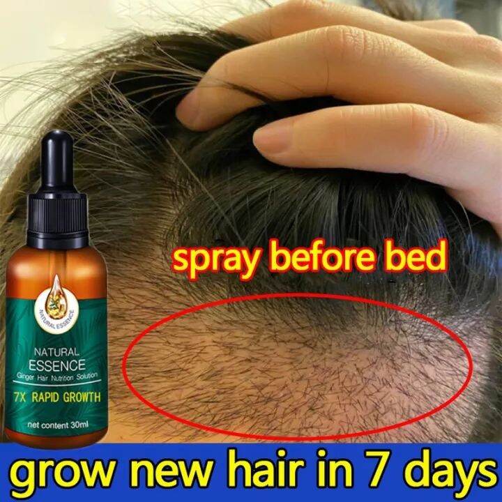 Semprotan Penumbuh Rambut Hair Growth Serum Hair Growth Spray Repair