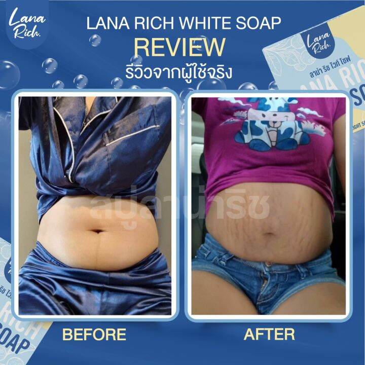 พร้อมส่ง-สบู่ลาน่า-ริช-lana-rich-white-soap-ลา-น่า-ริช-เร่งขาว-ขาวเเรงง-สบู่ผิวตัว-ผสมอาร์บูติน-และ-กลูต้า-ลดรอยแตกลาย