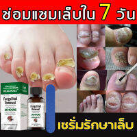 HEALMUSZ เซรั่มบำรุงเล็บ เชื้อราเล็บมือ แก้เชื้อราที่เล็บ บำรุงเล็บ ลากับเล็บเสีย ไม่ทำร้ายเล็บดี ห่างกับปัญหาเล็บ（ ซ่อมแซมเล็บ ยาเชื้อราเล็บ เชื้อราที่เล็บ ยารักษาเล็บ บำรุงเล็บ ครีมบำรุงเล็บ ยารักษาเชื้อราที่เล็บ Fungal Nail ）