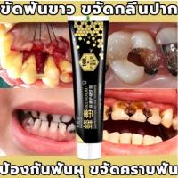 ลดฟันเหลือง ป้องกันฟันผุ ยาสีฟันน้ำผึ้งธรรมชาติ BANGCHILING ลดหินปูน คราบฟัน ปวดฟัน มูสฟอกฟันขาว น้ำยาขัดฟันขาว ยาสีฟันฟอกฟันขาว ยาสีฟันน้ำผึ้ง ยาสีฟันฟอกขา ยาสีฟัน ยาสีฟันขจัดปูน ฟันผุ ยาสีฟันฟันขาว ปวดฟันผุ ฟันขาว ยาสีฟันสมุนไพร bee venom