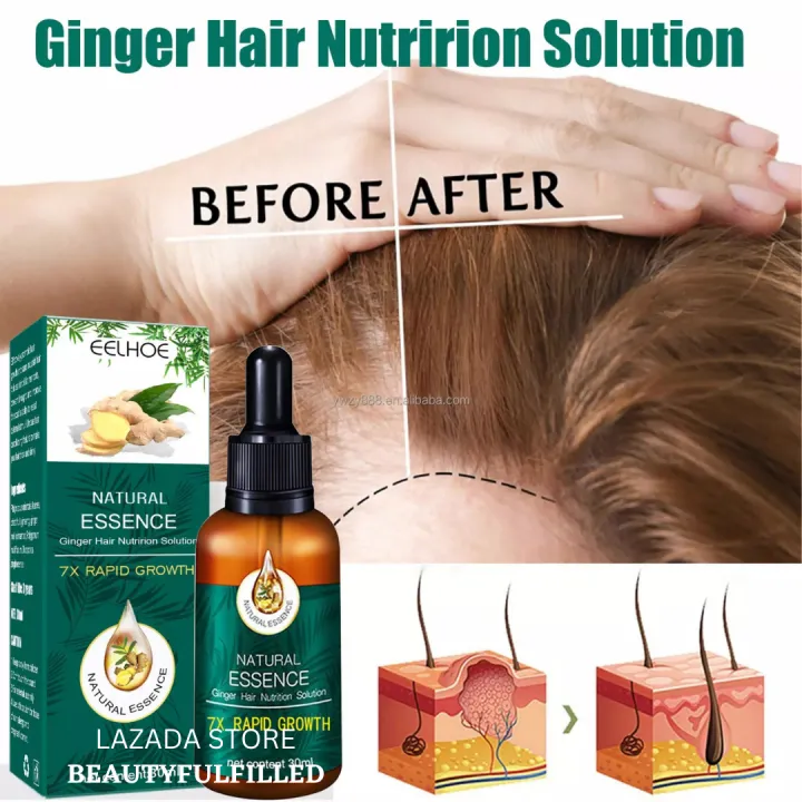 Ginger Hair Growth Oil for Hair Grower for Men Original Eelhoe Hair Growth  Hair Serum Hair Grower for Hair Loss Hair Thinning Hair Fall Bald Hair  Regrow | Lazada PH