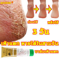 R MALL ครีมส้นเท้าแตก 100ml เหมาะสำหรับส้นเท้าแตก ผิวแตก บำรุงผิว ครีมสันเท้าแตก ครีมทาเท้าขาว ครีมทาเท้า ครีมบำรุงเท้า ครีมทาเท้าขาว ครีมทาส้นเท้า ครีมทาส้นเท้าแตก ครีมทาส้นแตก ครีมเท้าขาว ครีมบำรุงส้นเท้า ดูแลเท้า