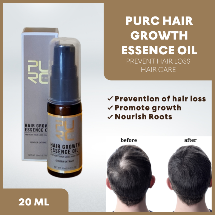 Purc Original 100 Pure Natural Hair Growth Oil 20ml Ginger Hair