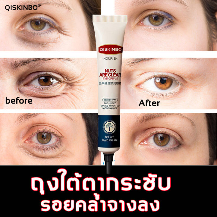 qiskinbo-ครีมถุงใต้ตา-20g-อายครีม-ครีมลดถุงใต้ตา-ครีมลบรอยตีนกา-คลีมลดถุงใต้ตา-บำรุงรอบดวงตา-แก้ใต้ตาคล้ำ-ครีมบำรุงรอบดวงตา-ครีมทาใต้ตา-ครีมทารอบดวงตา-อายครีมบำรุงตา-ขอบตาดำ-รอยตีนกา-ครีมแก้ขอบตาดำ-ey