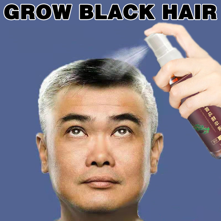 Herbal Cure White Hair Treatment Spray 100ML Herbal Shouwu Hair Liquid  Remedies Change White Gray Hair To Black Permanently In 30 Days Naturally |  Lazada