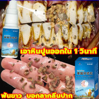 ⚡️เอาหินปูนออกใน 1 วินาที น้ำยากำจัดหินปูน30ML ขจัดคราบหินปูน น้ำยากำจัดหินปูน ยาสีฟันฟอกฟันขาว กําจัดนิ่วในฟัน ยาสีฟันฟันขาว ซ่อมฟันเหลือง ฟันขาวขึ้น น้ำยาขัดฟันขาว หินปูน Dental stone spray