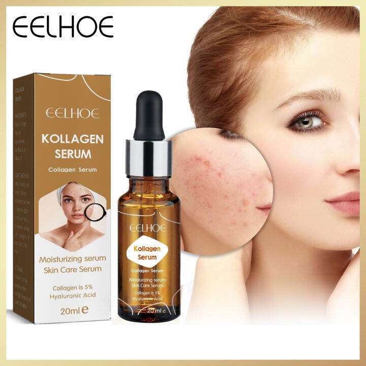 Eelhoe Acne Treatment Face Serum Acne Dark Patches Removal Repair ...