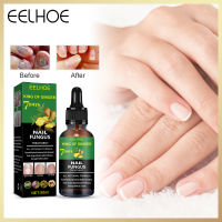 Eelhoe 7 Days Foot Anti-Fungal Essence To Remove Onychomycosis Repair Liquid Repair Nail Fungus Essence Foot Care Serum Toe Nails Fungal Removal Nail Care 50ml