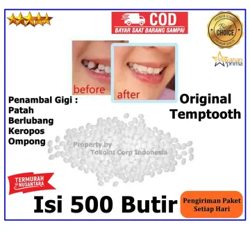 Jual Tambal Gigi Anti Copot Terbaru - Jan 2024