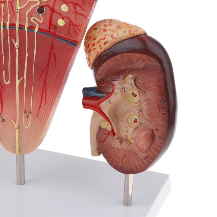 dolity-ไตมนุษย์แบบขยาย-nephron-glomeruli-แบบการเรียนการสอนในโรงเรียนอุปกรณ์ห้องปฏิบัติการ