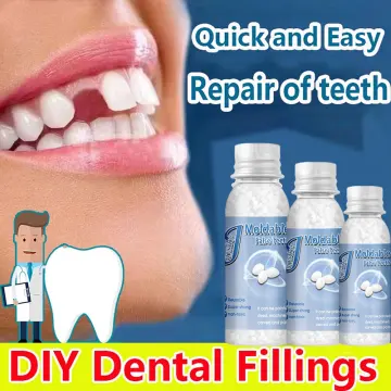 Solid Teething Gum Temporary Tooth Kit Repair Teeth Gaps Filling