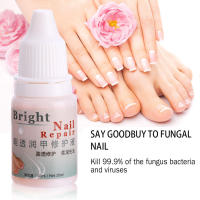 1PC 10ml Fungal Nail Treatment Gel ไวท์เทนนิ่ง Toe Nails Care Essence Fungus Removal Liquid