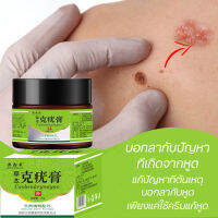 ที่ลอกหูดตาปลา ติ่งเนื้อ เห็นผลทันทีเมื่อใช่ต่อเนื่อง Corns warts prickles calluses flat removal cream ครีมแต้มหูด ลอกหูดตาปลา ปลอดภัยไม่เจ็บ