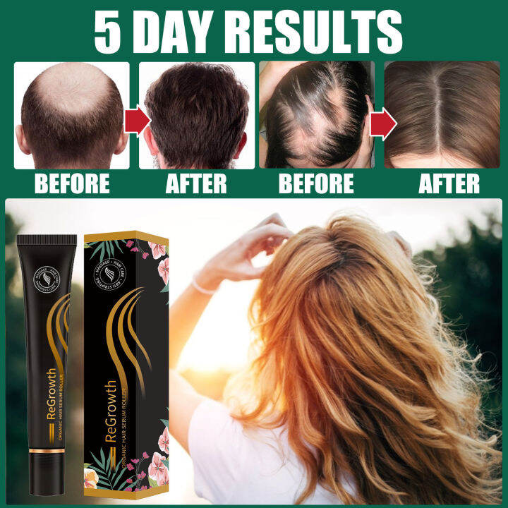 Regrowth Organic Hair Growth Serum Roller, Triple Ball Roller Hair