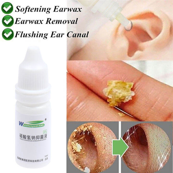 😍 boloni 10ml Ear Drops Sodium Bicarbonate Earwax Cleaner Liquid Otitis